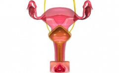 白带增多有异味可能是宫颈炎的症状