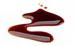 宫颈炎跟什么有关 每天一口醋防宫颈炎